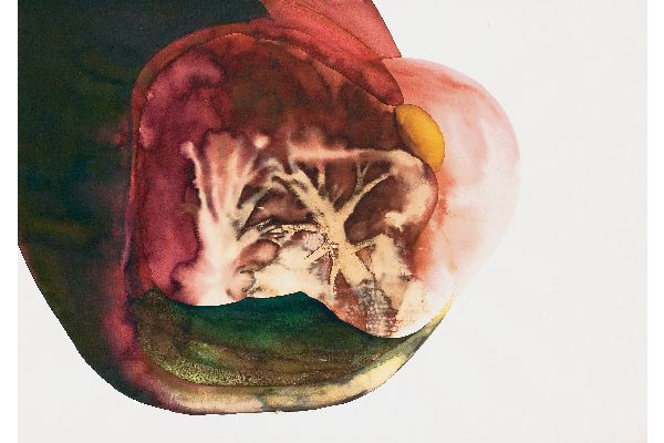Tumour (from the series Interior Secrets of the Body)